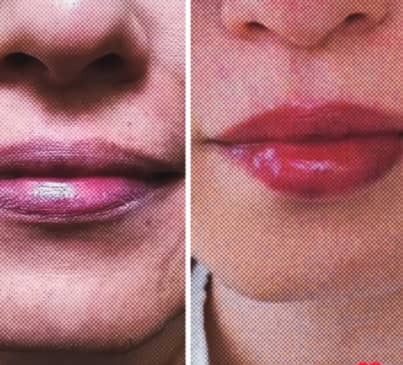 Slider image (2) Medica Golfo de Cortes